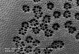 11 - Pori del concettacolo contornati da cellule disposte a rosetta